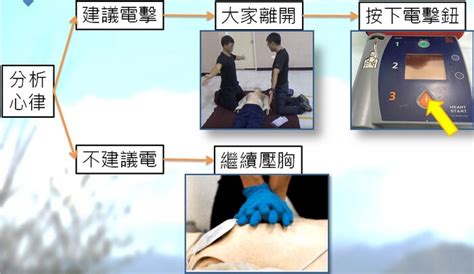 口對口|心肺復甦術 Cardiopulmonary Resuscitation (CPR)